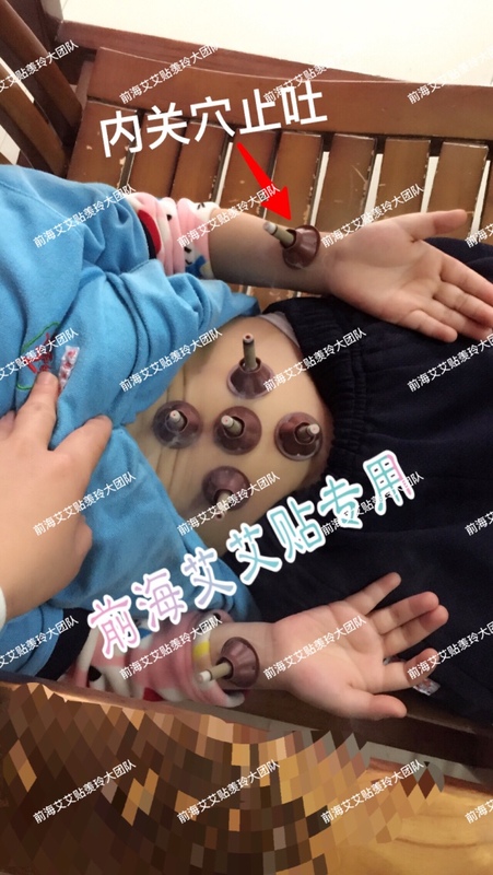 01 第一组:灸前没精神,灸完后没再吐.jpg