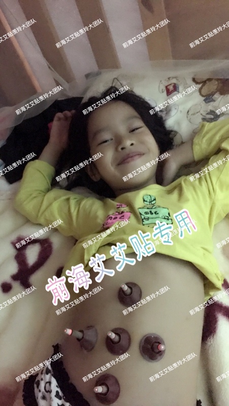 02 第二组:中腕、神阙、天枢、关元.jpg